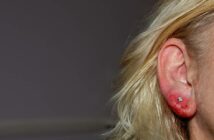 Allergie Piercing: Eine vielversprechende Methode zur Linderung von Allergiesymptomen (Foto: AdobeStock - 818930423 Claudia Evans)