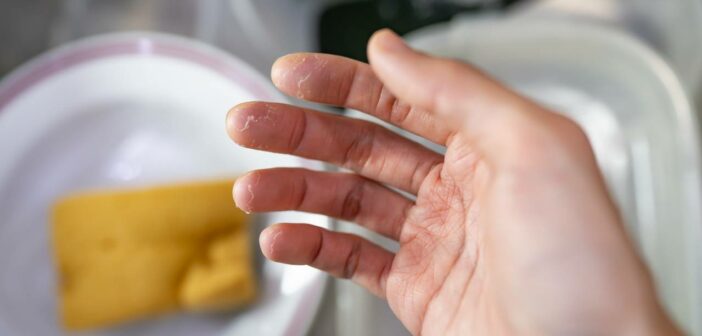 Waschmittel bei Allergien: Schutz für empfindliche Kinderhaut (Foto: AdobeStock - 649129151 wachiwit)